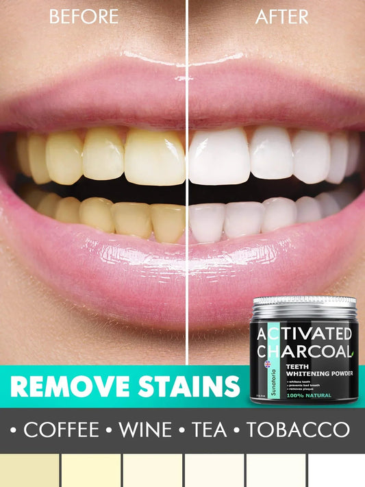 The Ultimate 5-in-1 Teeth Whitening Powder: Achieve a Radiant Smile Naturally